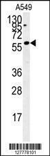 Anti-PARPBP Rabbit Polyclonal Antibody (AP (Alkaline Phosphatase))