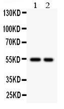 Anti-Cystatin A Rabbit Polyclonal Antibody