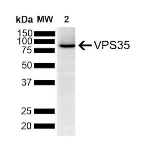 Western blot analysis of human SH-SY5Y showing detection of VPS35 protein using Anti-VPS35 Antibody [5A9] (A305033) at 1:1000 for 2 hours at room temperature with shaking