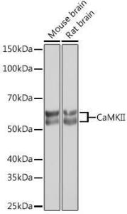 Anti-CaMKII beta antibody