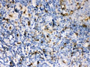 Anti-Cystatin A Rabbit Polyclonal Antibody