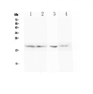 Anti-BCMA Polyclonal Antibody