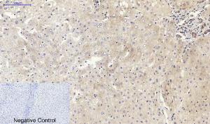 Immunohistochemical analysis of paraffin-embedded human liver tissue using Anti-CDH2 Antibody at 1:200 (4 °C overnight). Negative control was secondary antibody only