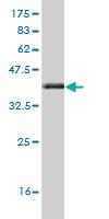 Anti-FZD3 Mouse Monoclonal Antibody [clone: 2H5]