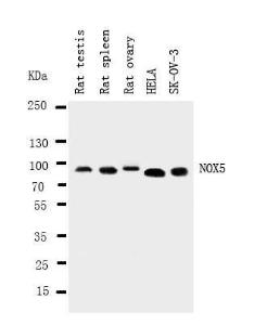 Anti-NOX5 Rabbit Polyclonal Antibody