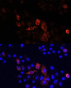 Immunofluorescence analysis of HeLa cells using Anti-NADH2 [9E12-1B3] Antibody (A92937) at a dilution of 1:100 DAPI was used to stain the cell nuclei (blue)