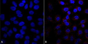 Immunocytochemistry/Immunofluorescence analysis of human A549 cells, using Anti-VPS35 Antibody [5A9] (A305033), at 1:5 (tissue culture supernatant)