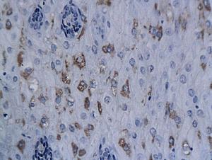 Anti-XRCC1 Rabbit Polyclonal Antibody