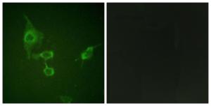 Immunofluorescence analysis of HepG2 cells using Anti-HCK Antibody. The right hand panel represents a negative control, where the antibody was pre-incubated with the immunising peptide