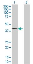 Anti-TMOD2 Rabbit Polyclonal Antibody