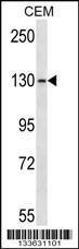 Anti-GRM1 Rabbit Polyclonal Antibody (APC (Allophycocyanin))