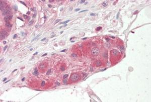 Anti-KLF8 Antibody (A83233) (3.75µg/ml) staining of paraffin embedded Human Small Intestine. Steamed antigen retrieval with citrate buffer pH 6, AP-staining.