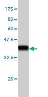 Anti-TEAD4 Mouse Monoclonal Antibody [clone: 5H3]