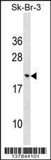 Anti-CNIH3 Rabbit Polyclonal Antibody (AP (Alkaline Phosphatase))