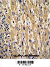 Anti-GAL Rabbit Polyclonal Antibody (FITC (Fluorescein Isothiocyanate))