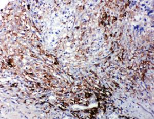 Anti-LTBR Rabbit Polyclonal Antibody