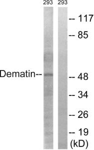 Western blot analysis of lysates from 293 cells using Anti-Dematin Antibody. The right hand lane represents a negative control, where the antibody is blocked by the immunising peptide