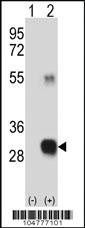 Anti-RCE1 Rabbit Polyclonal Antibody