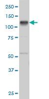 Anti-EPHB3 Mouse Monoclonal Antibody [clone: 1E12]