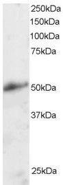 Anti-KLF8 Antibody (A83233) staining (2µg/ml) of Human Kidney lysate (RIPA buffer, 30µg total protein per lane). Primary incubated for 1 hour. Detected by chemiluminescence.