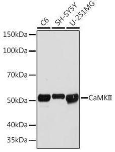 Anti-CaMKII beta antibody