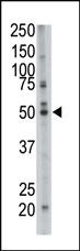 Anti-FDFT1 Rabbit Polyclonal Antibody