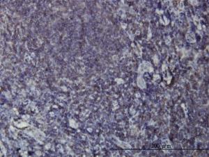 Anti-EPHB3 Mouse Monoclonal Antibody [clone: 1E12]