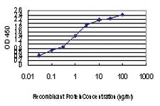 Anti-UBE3A Mouse Monoclonal Antibody [clone: 2F6]