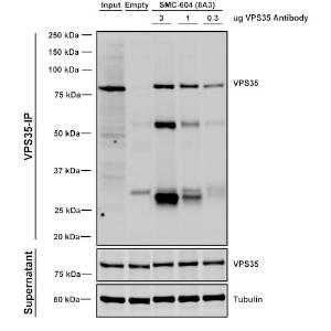 Immunoprecipitation analysis of mouse embryonic fibroblast using Anti-VPS35 Antibody [8A3] (A305034). Three amounts of A305034 (3, 1 and 0.3 ug) were non-covalently coupled to 10uL of A/G sepharose beads for 1 hour at 4°C and next incubated with 250ug of MEF lysate for 2 hours at 4°C.