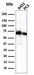 Western blot analysis of A431 and PC-3 cell lysates using Anti-CD73 Antibody [NT5E/2505]