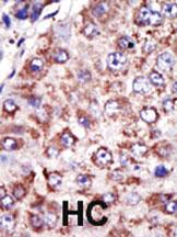 Anti-FDFT1 Rabbit Polyclonal Antibody