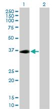 Anti-ADORA2 Mouse Polyclonal Antibody