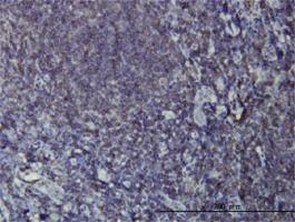 Anti-EPHB3 Mouse Monoclonal Antibody [clone: 1E12]