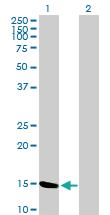 Anti-MGST2 Mouse Polyclonal Antibody