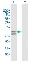 Anti-UGGT2 Rabbit Polyclonal Antibody