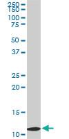 Anti-TIMM9 Mouse Monoclonal Antibody [clone: 1D6]