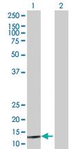 Anti-SUMO1 Mouse Polyclonal Antibody