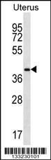 Anti-OR2V2 Rabbit Polyclonal Antibody (HRP (Horseradish Peroxidase))