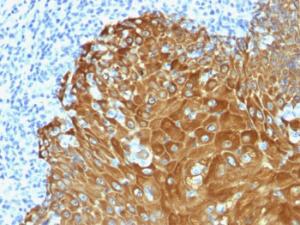 Immunohistochemical analysis of formalin-fixed, paraffin-embedded human skin using Anti-pan Cytokeratin Antibody