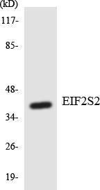 Western blot analysis of the lysates from HT 29 cells using Anti-EIF2S2 Antibody