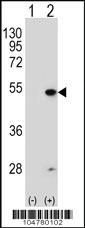 Anti-FDFT1 Rabbit Polyclonal Antibody