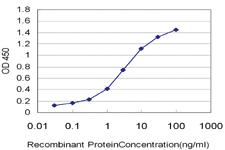 Anti-EPHB3 Mouse Monoclonal Antibody [clone: 1E12]