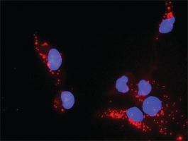 Anti-PTEN Mouse Monoclonal Antibody [clone: 2G9]