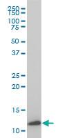 Anti-TIMM9 Mouse Monoclonal Antibody [clone: 1D6]