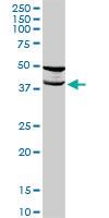 Anti-TMOD2 Rabbit Polyclonal Antibody