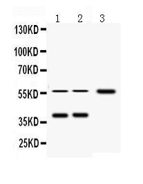 Anti-AHSG Antibody