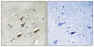 Immunohistochemical analysis of paraffin-embedded human brain tissue using Anti-Dematin Antibody. The right hand panel represents a negative control, where the antibody was pre-incubated with the immunising peptide