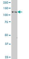 Anti-EPHB3 Mouse Monoclonal Antibody [clone: 2G9]