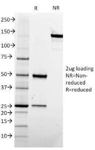 SDS-PAGE analysis of Anti-CD73 Antibody [NT5E/2505] under non-reduced and reduced conditions; showing intact IgG and intact heavy and light chains, respectively SDS-PAGE analysis confirms the integrity and purity of the antibody