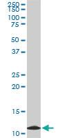 Anti-TIMM9 Mouse Monoclonal Antibody [clone: 1D6]